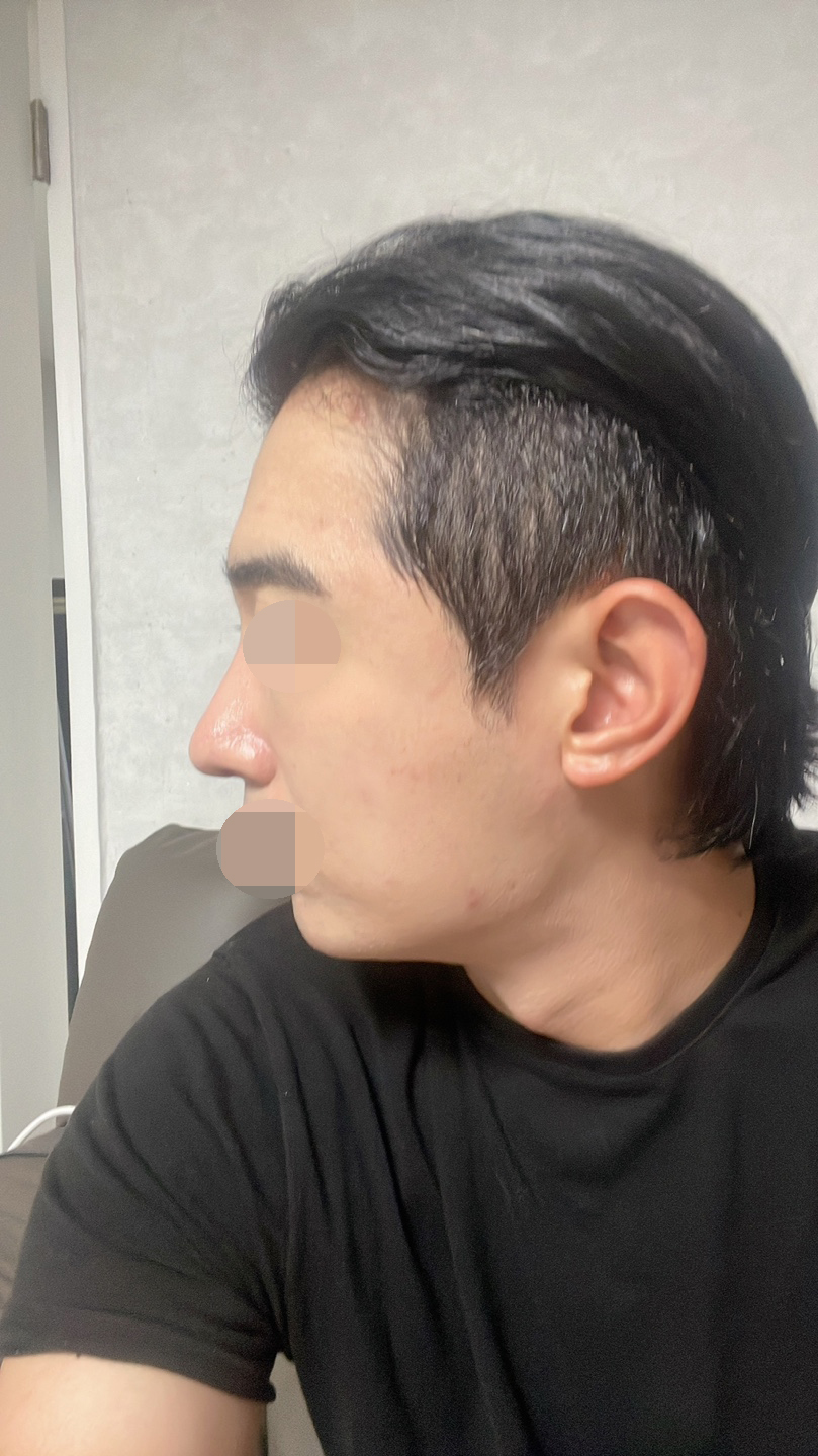 수술후기이미지