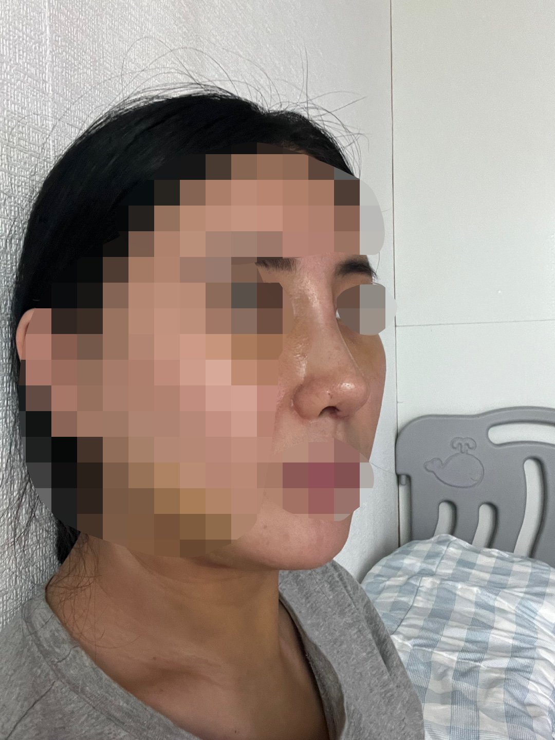 수술후기이미지