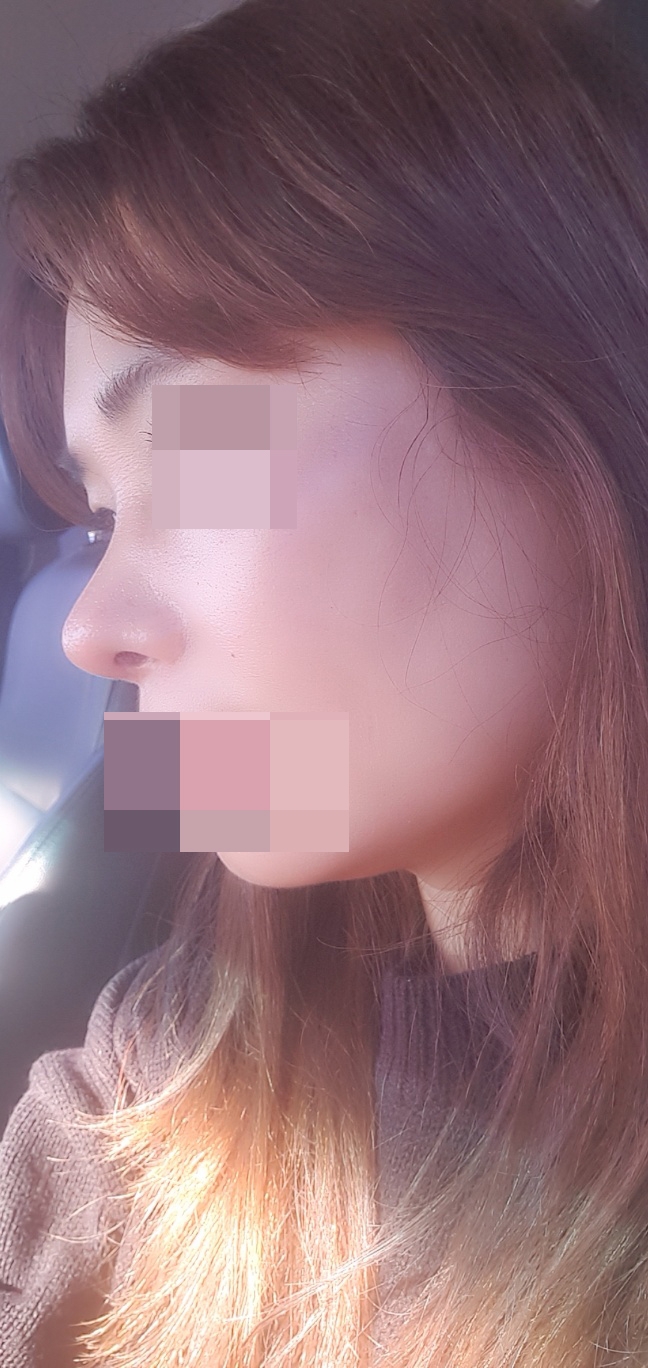 수술후기이미지