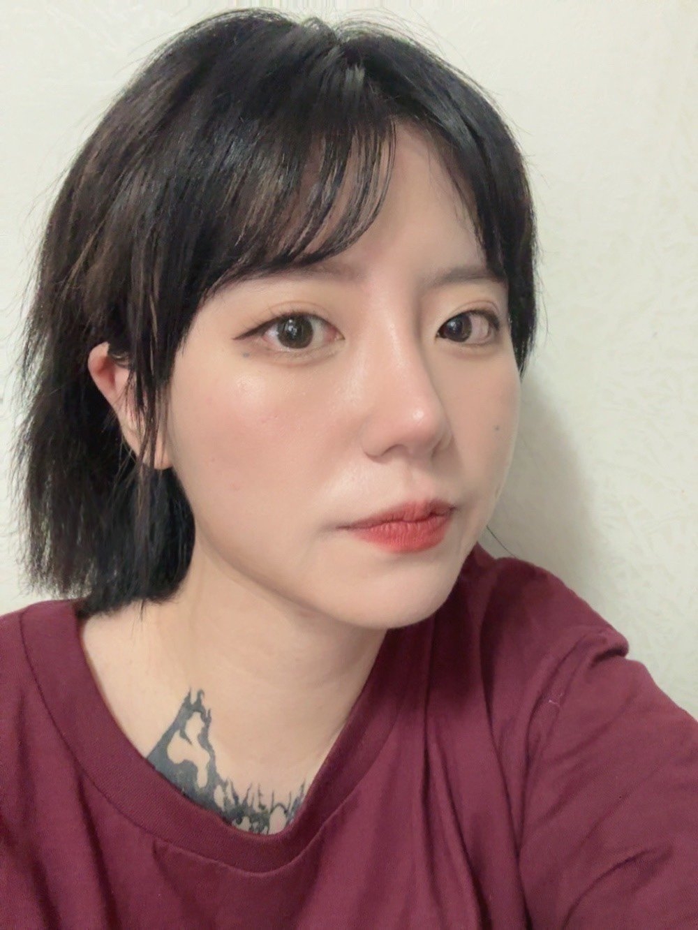 수술후기이미지