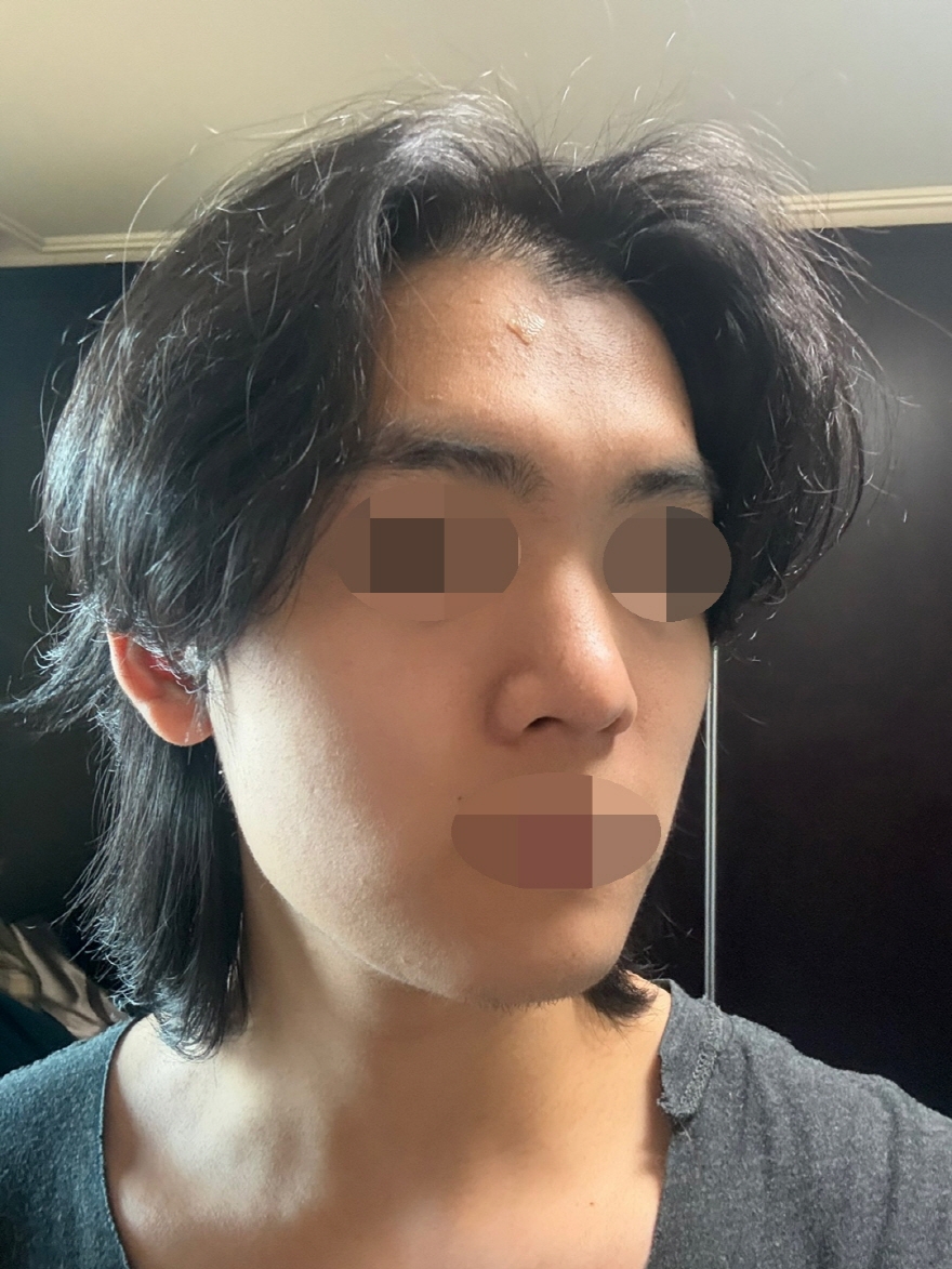 수술후기이미지