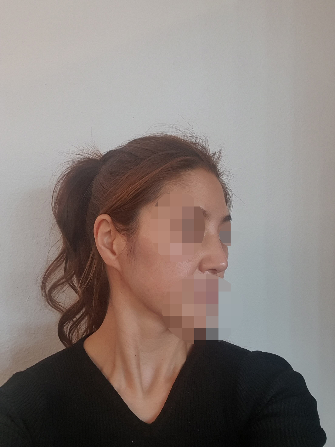 수술후기이미지