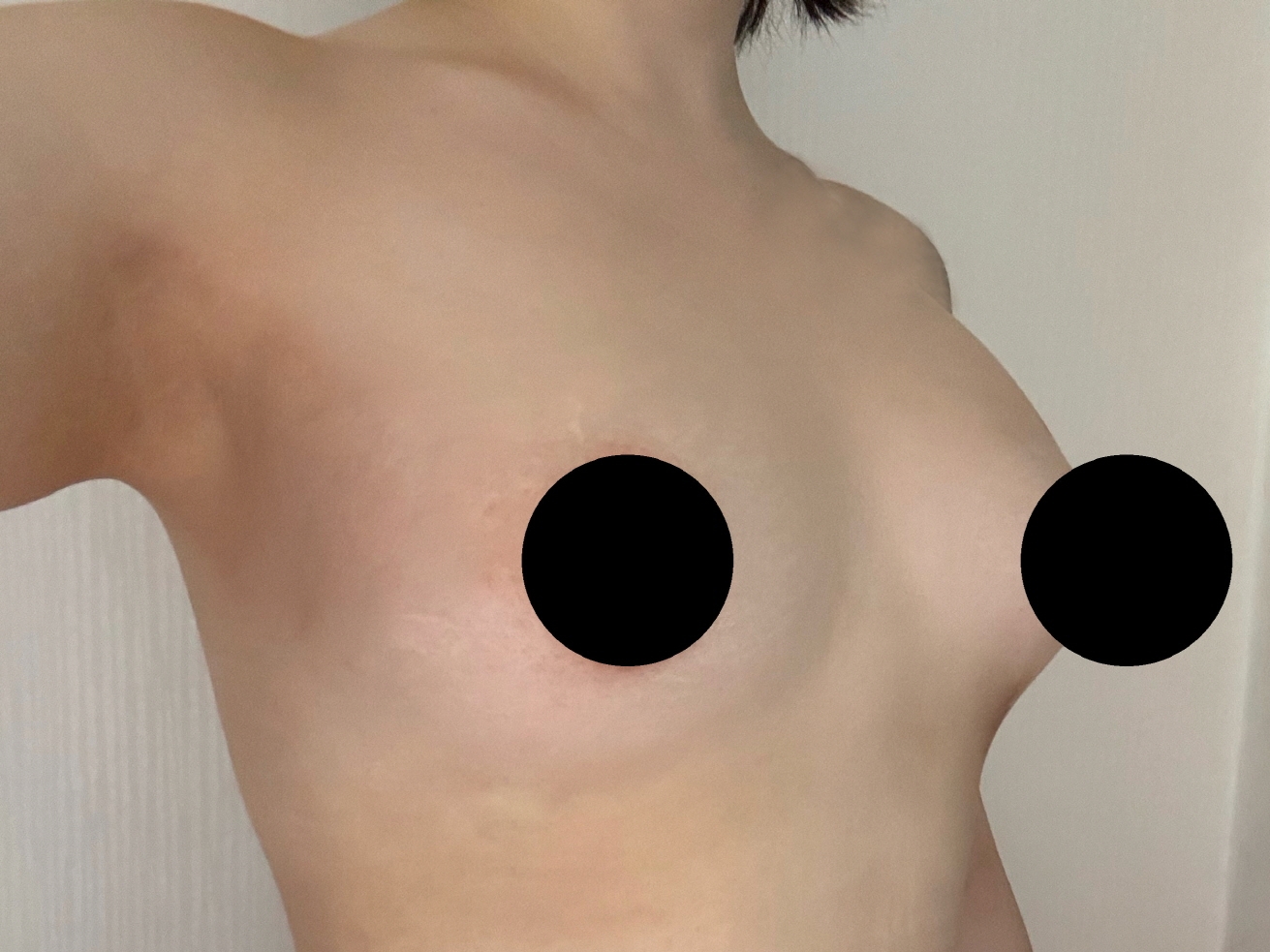 수술후기이미지