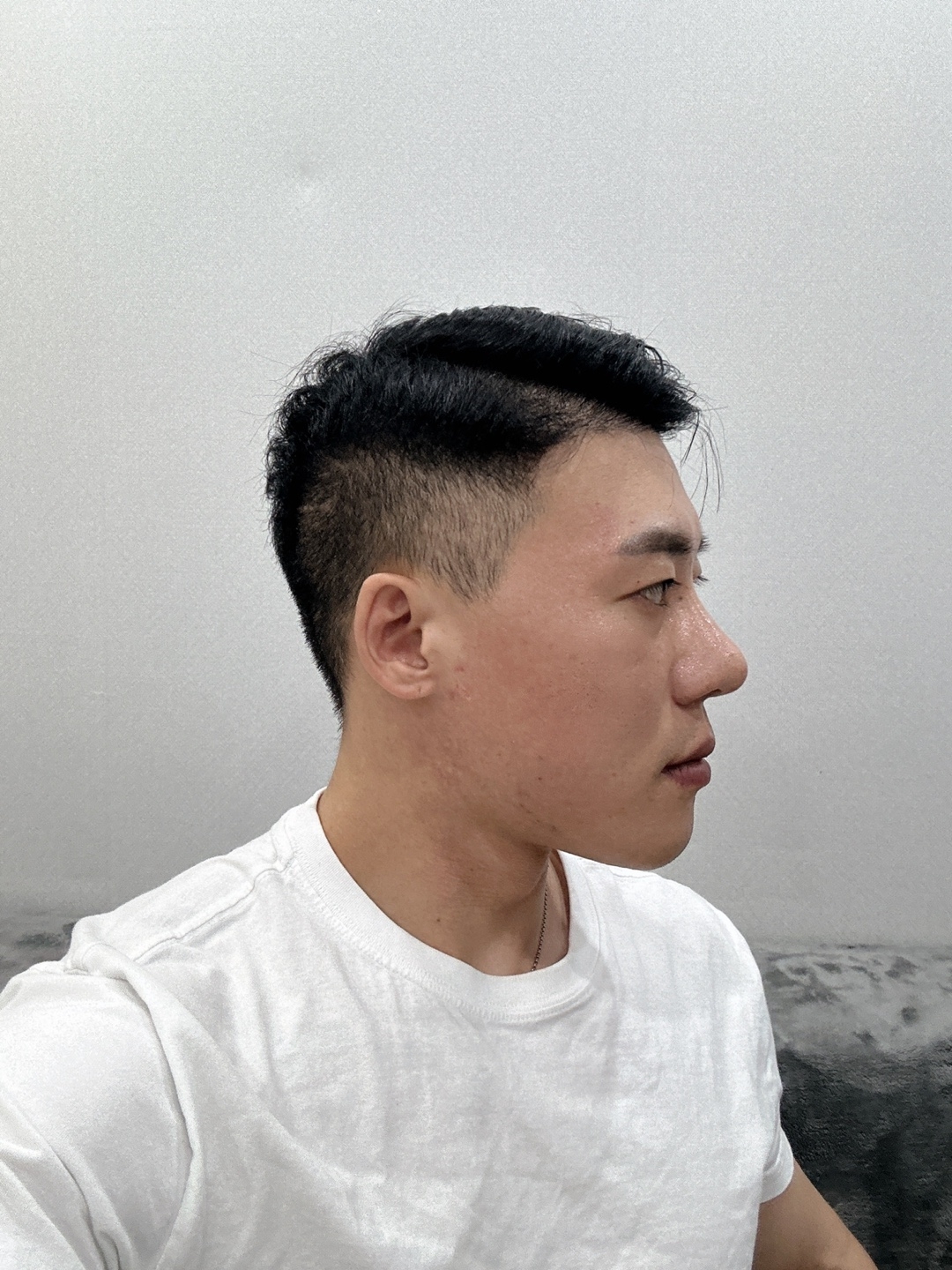 수술후기이미지