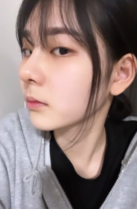 수술후기이미지