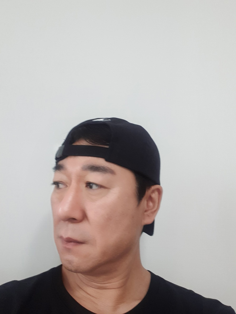 수술후기이미지