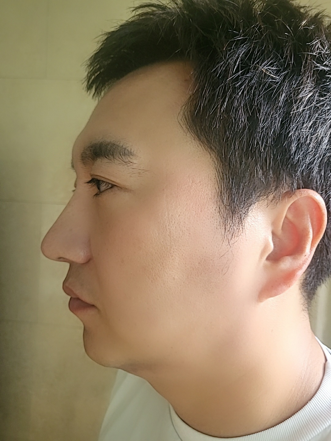 수술후기이미지