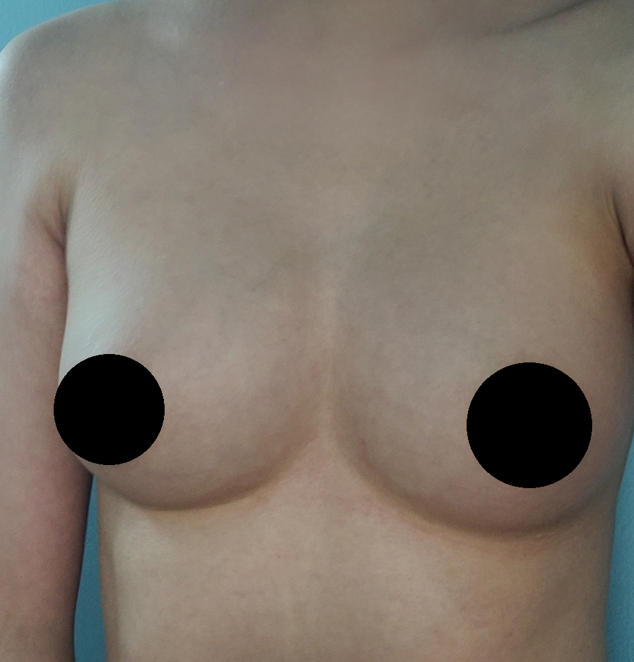 수술후기이미지