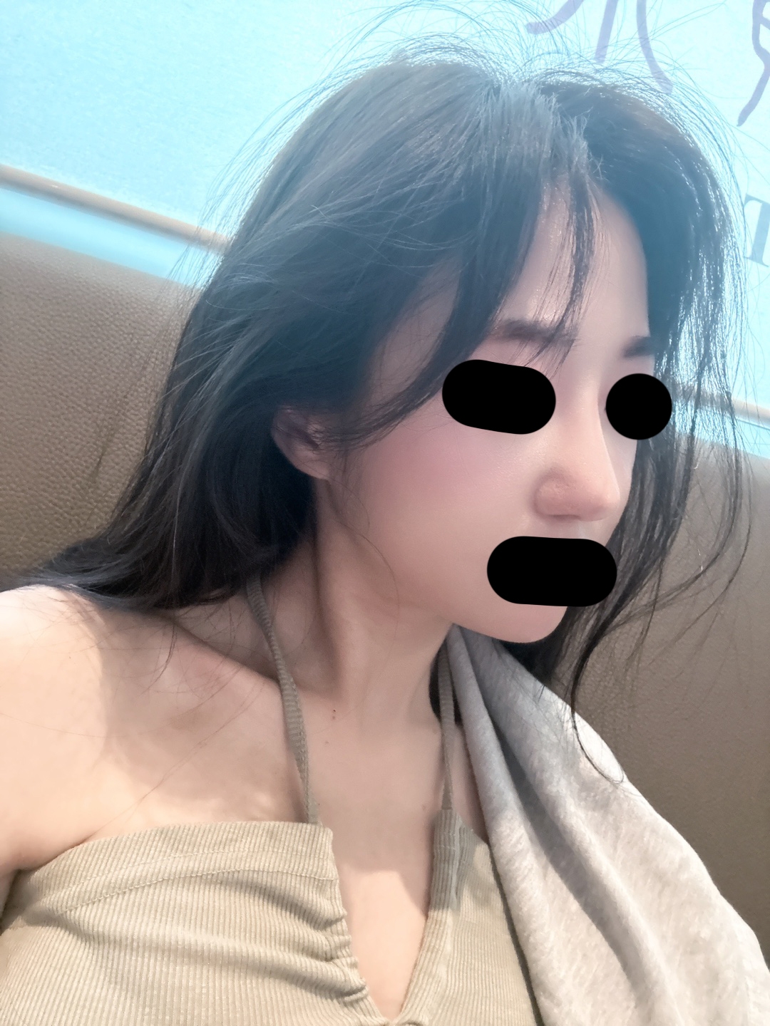 수술후기이미지