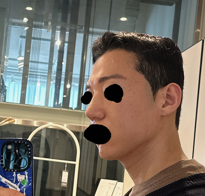 수술후기이미지