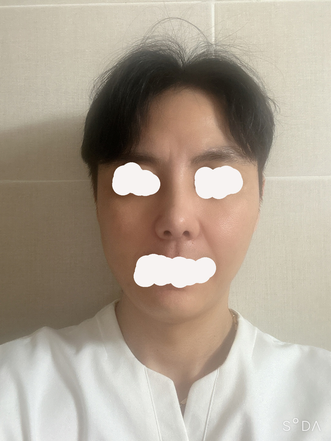 수술후기이미지