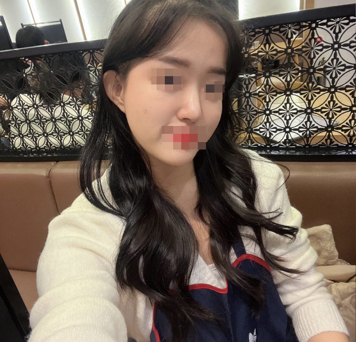 수술후기이미지