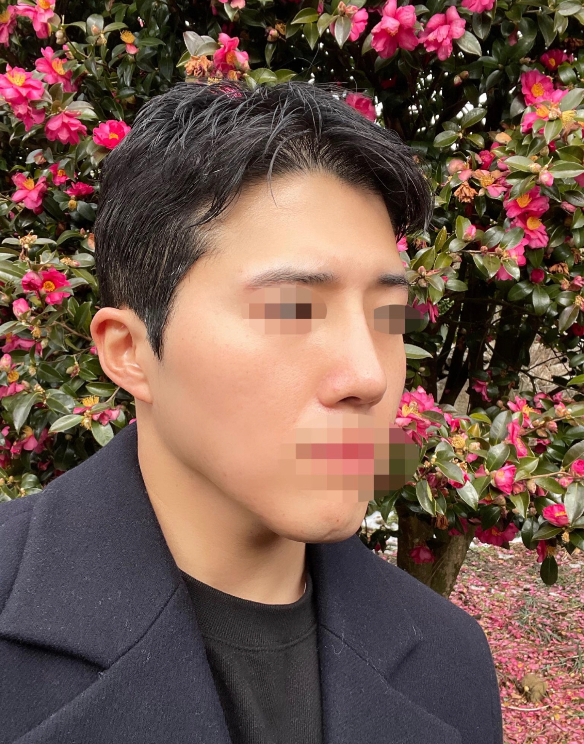 수술후기이미지