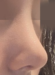 수술후기이미지