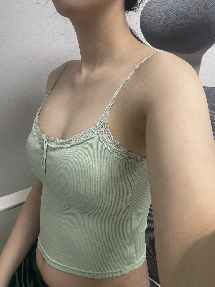 수술후기이미지