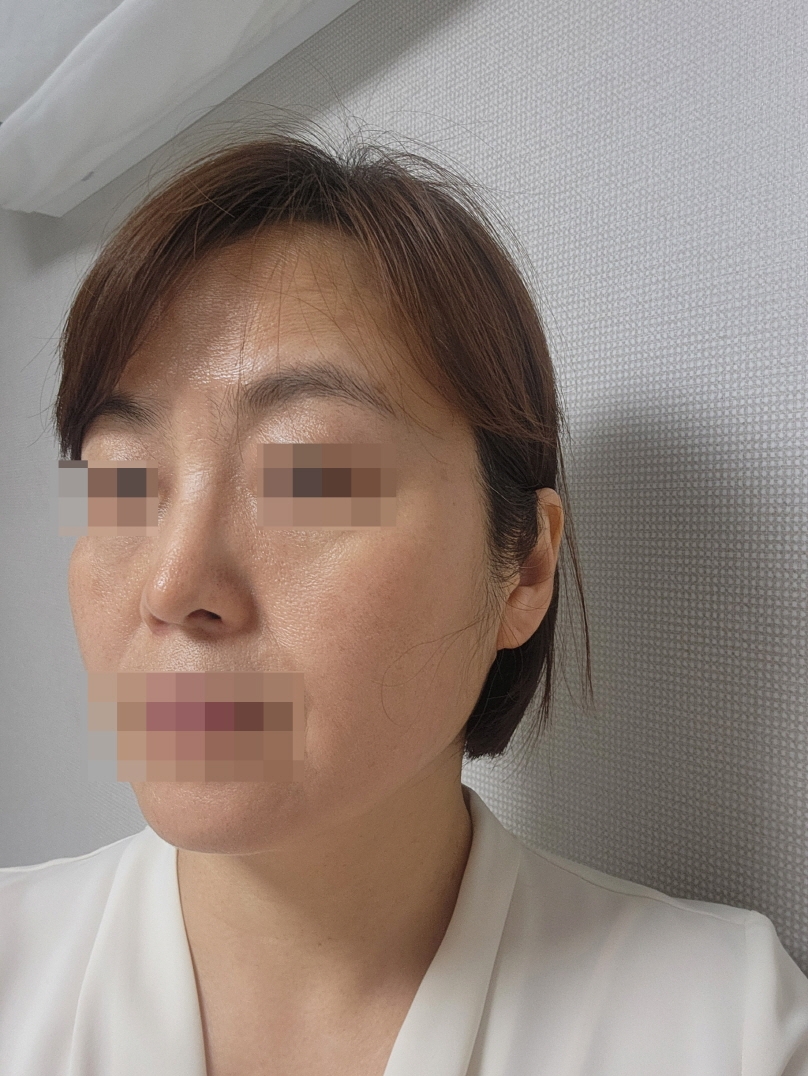 수술후기이미지