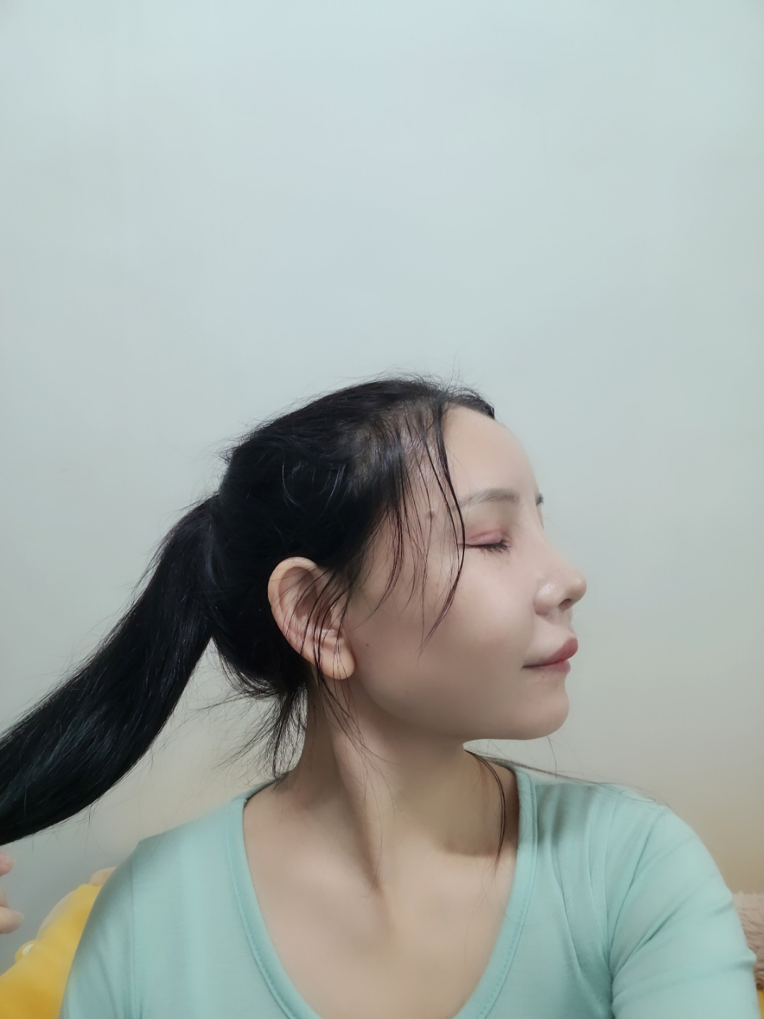 수술후기이미지