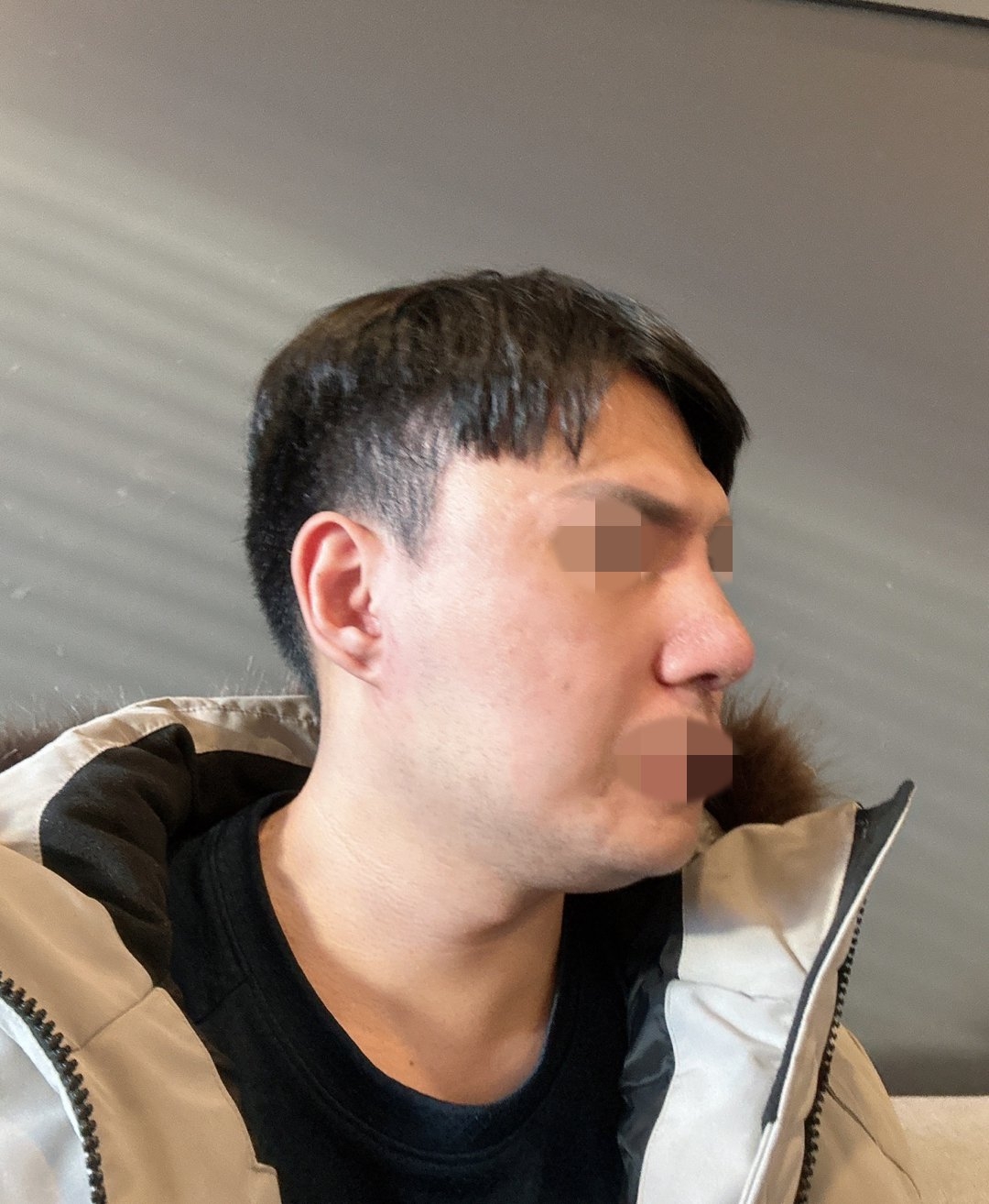 수술후기이미지