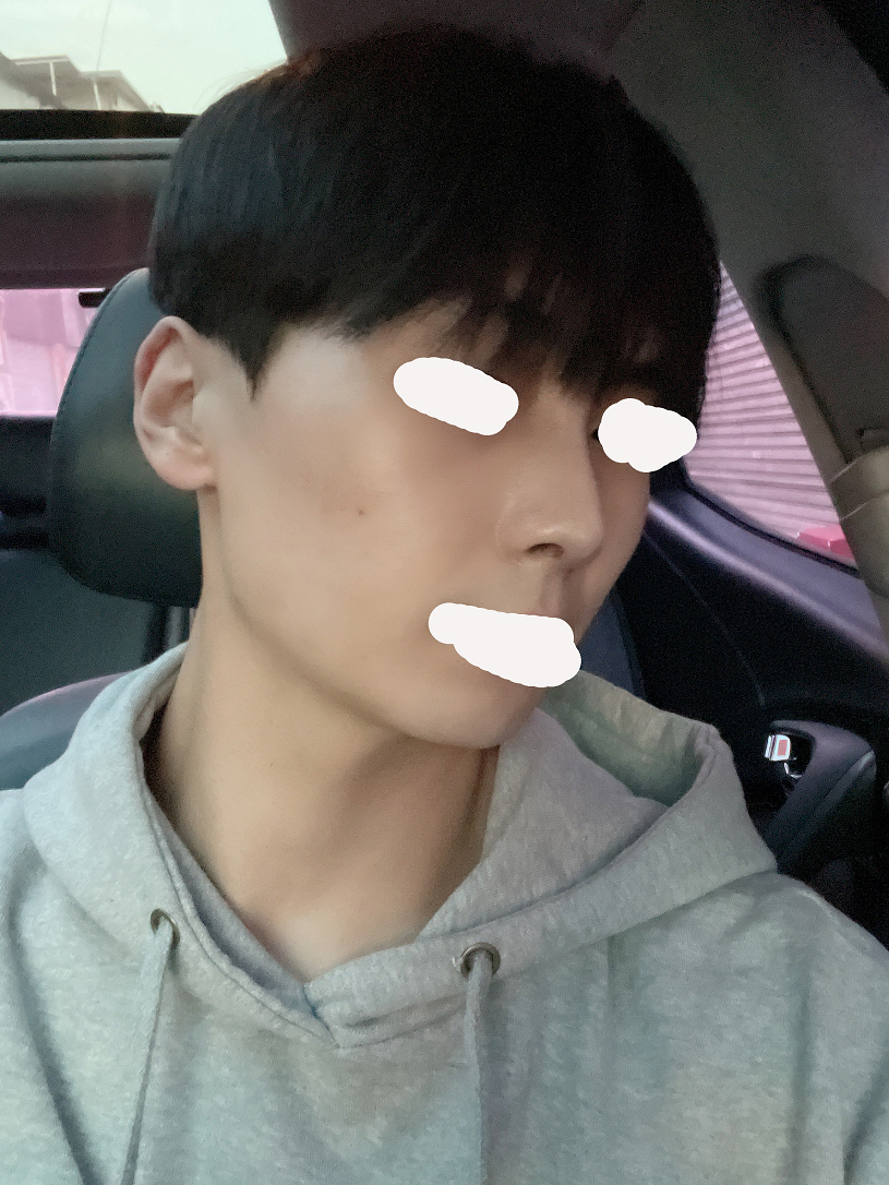 수술후기이미지