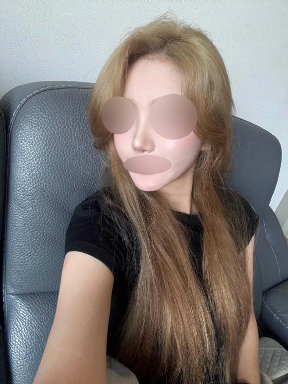 수술후기이미지