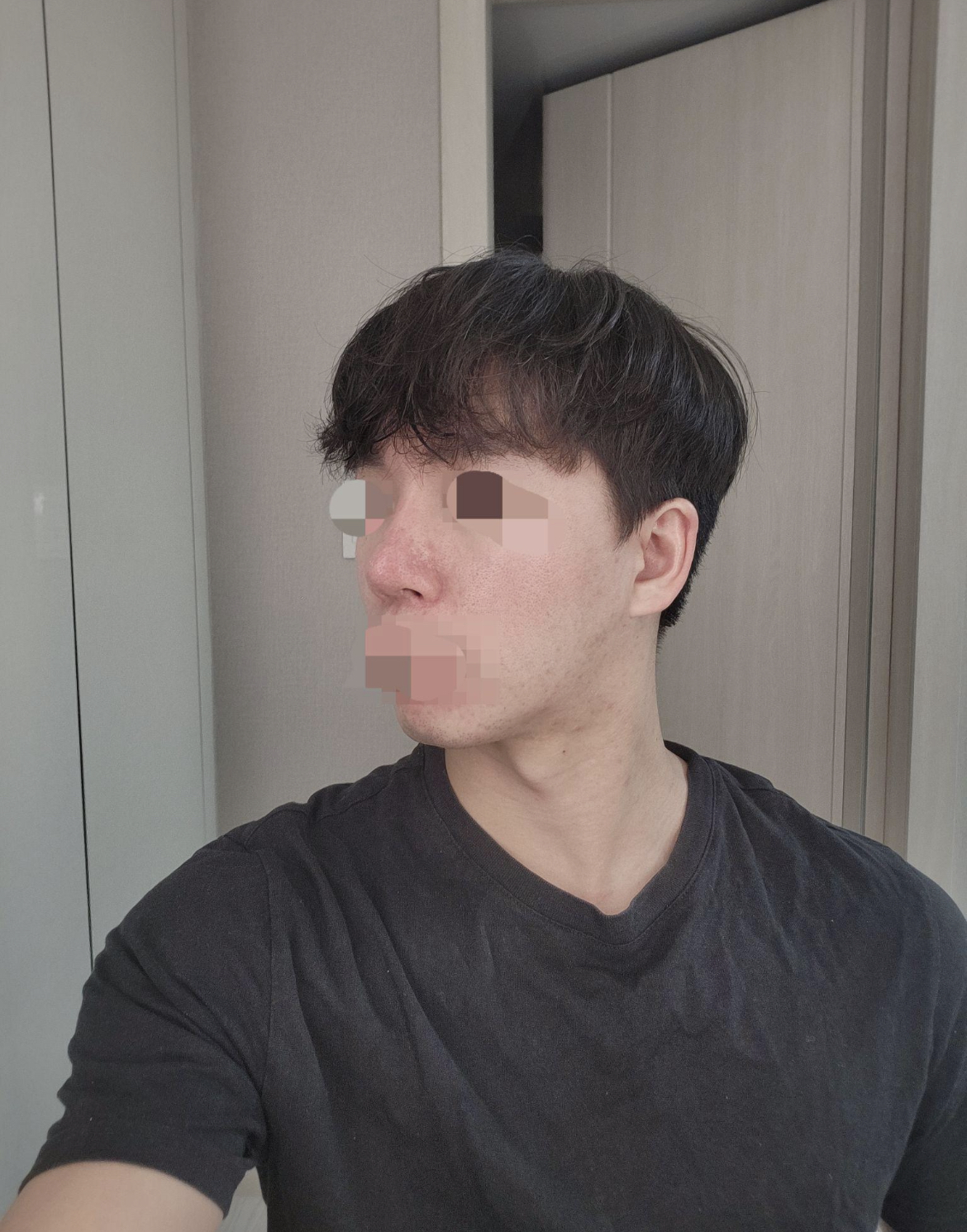 수술후기이미지