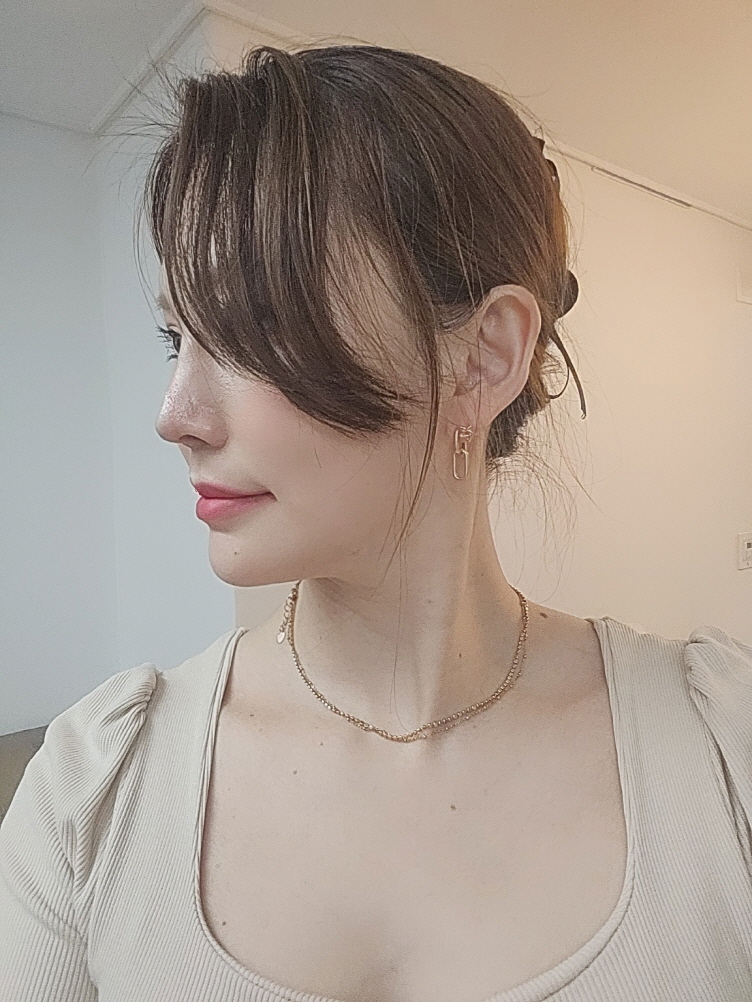 수술후기이미지