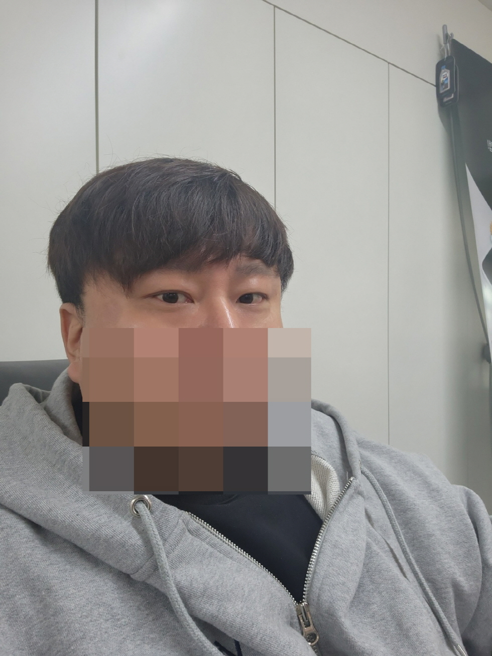 수술후기이미지