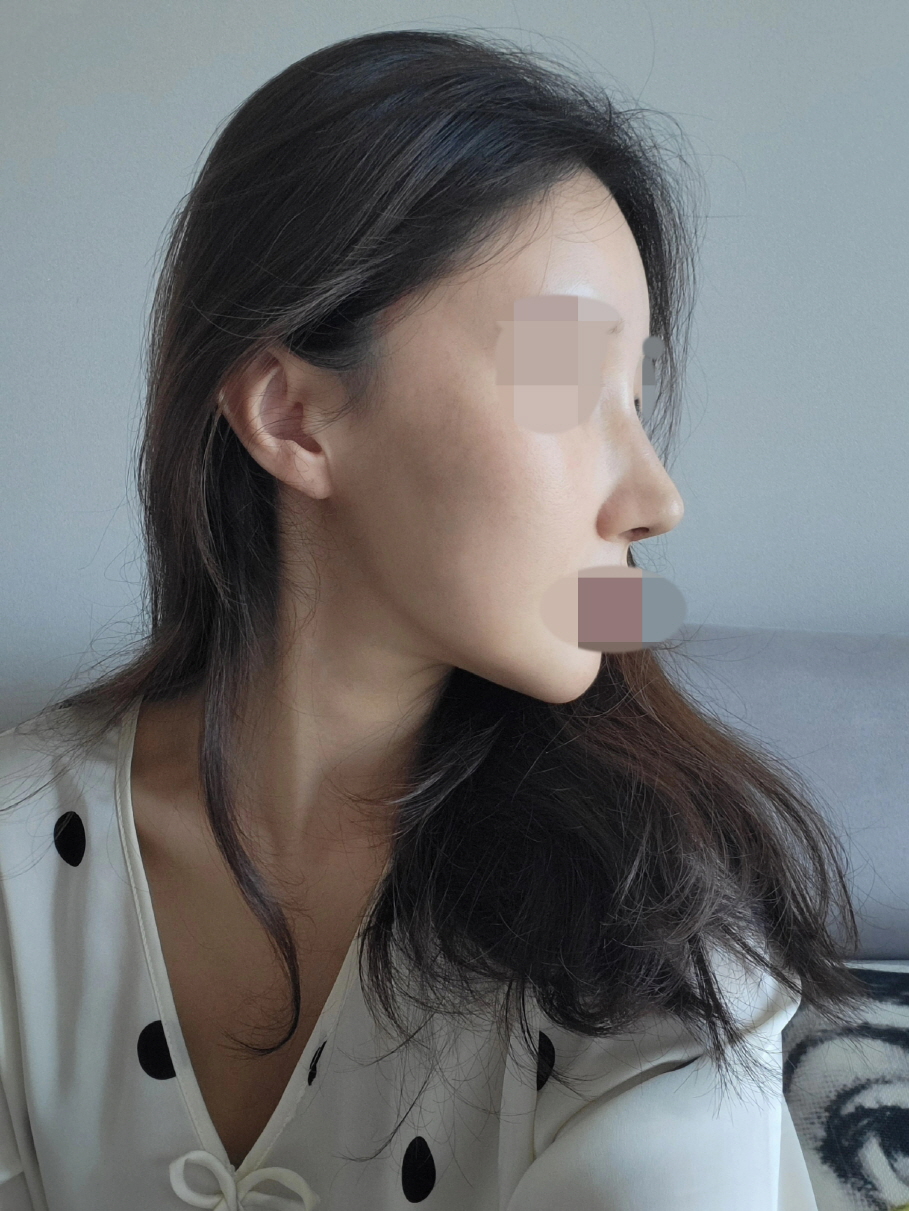 수술후기이미지