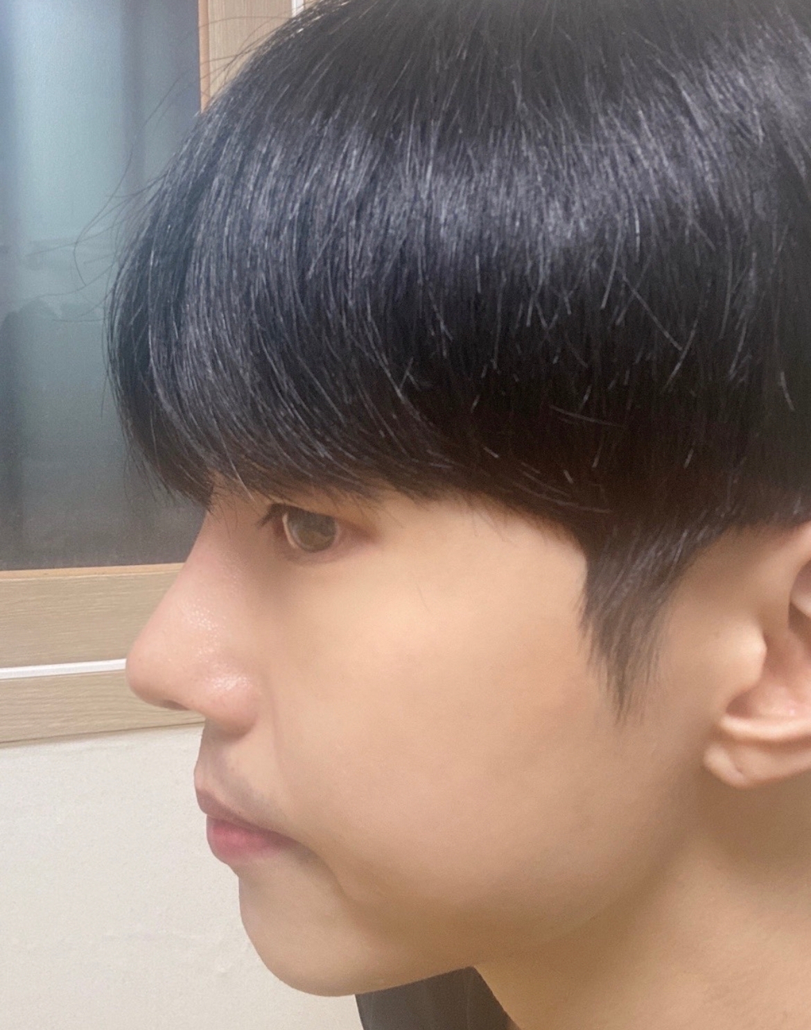 수술후기이미지