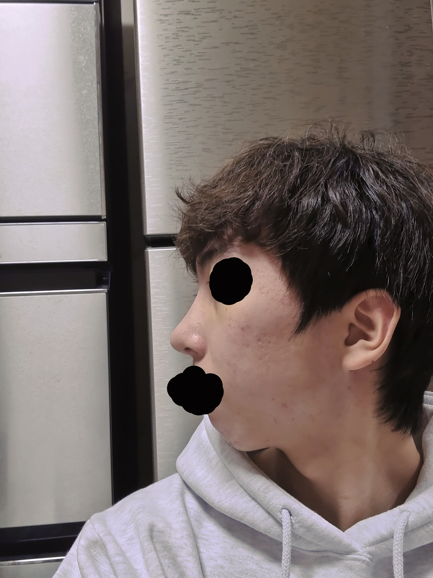 수술후기이미지