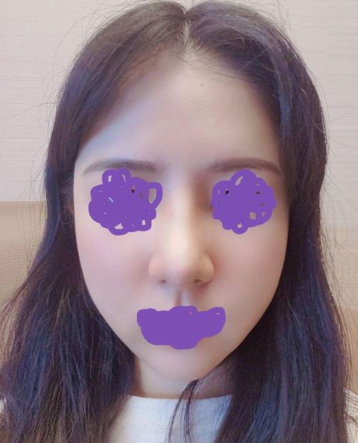 수술후기이미지