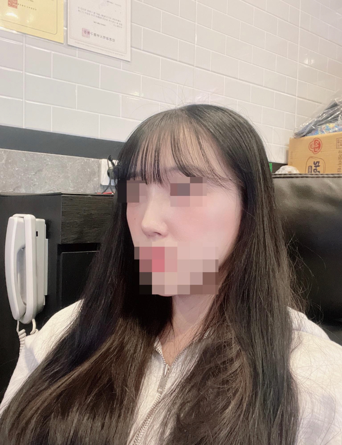 수술후기이미지