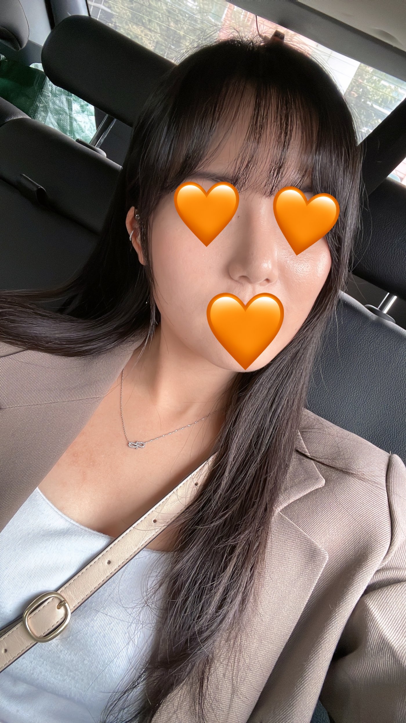 수술후기이미지