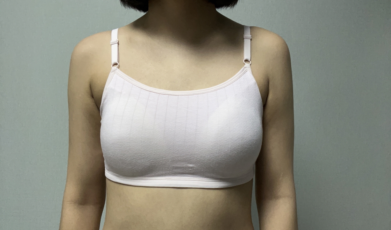 수술후기이미지