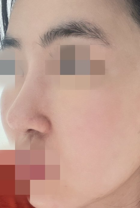 수술후기이미지