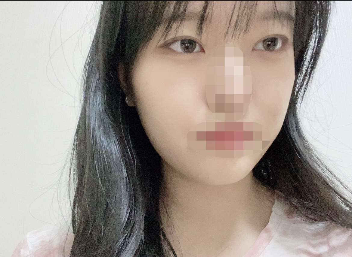 수술후기이미지