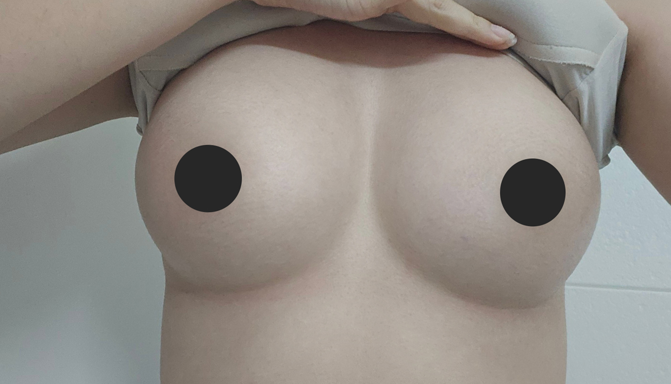 수술후기이미지