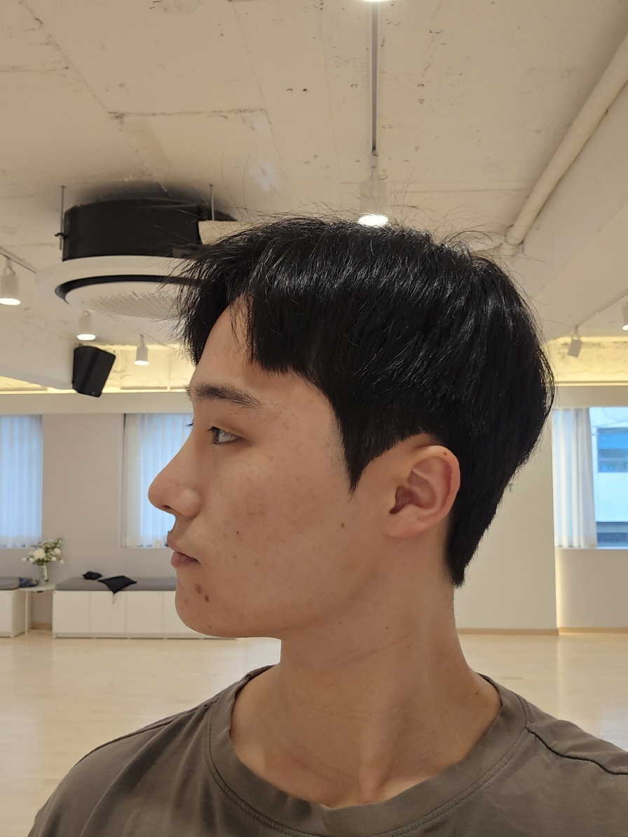 수술후기이미지