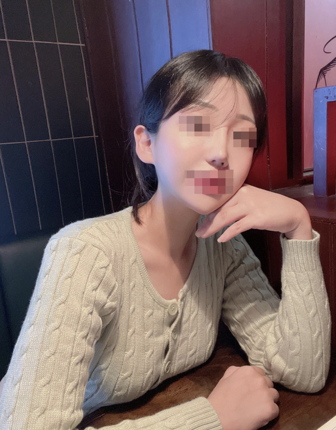 수술후기이미지