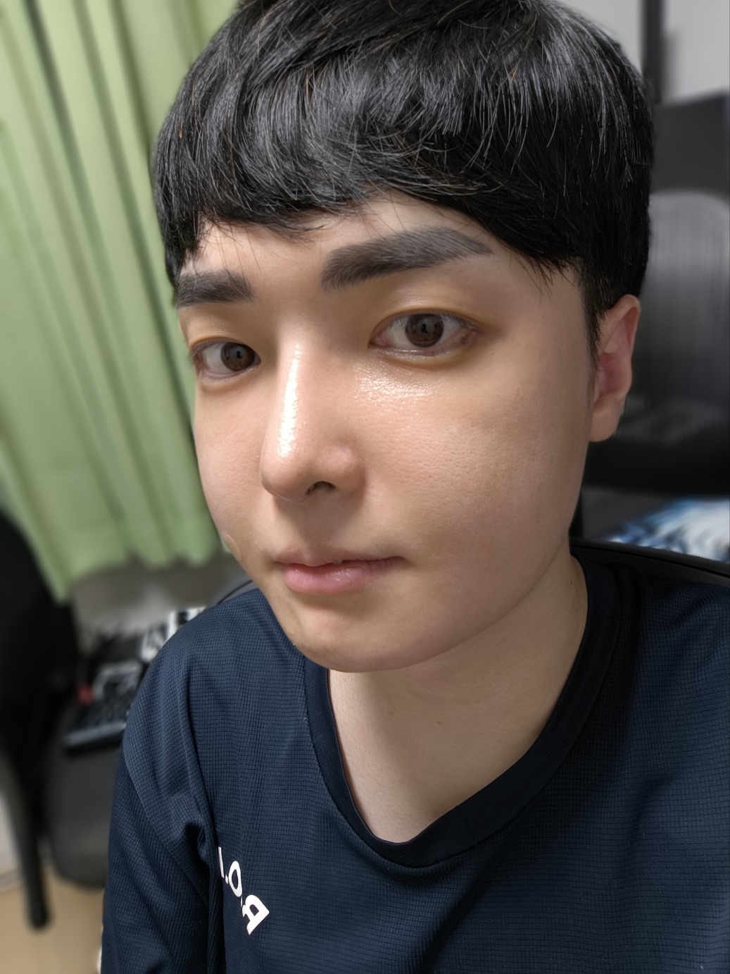 수술후기이미지