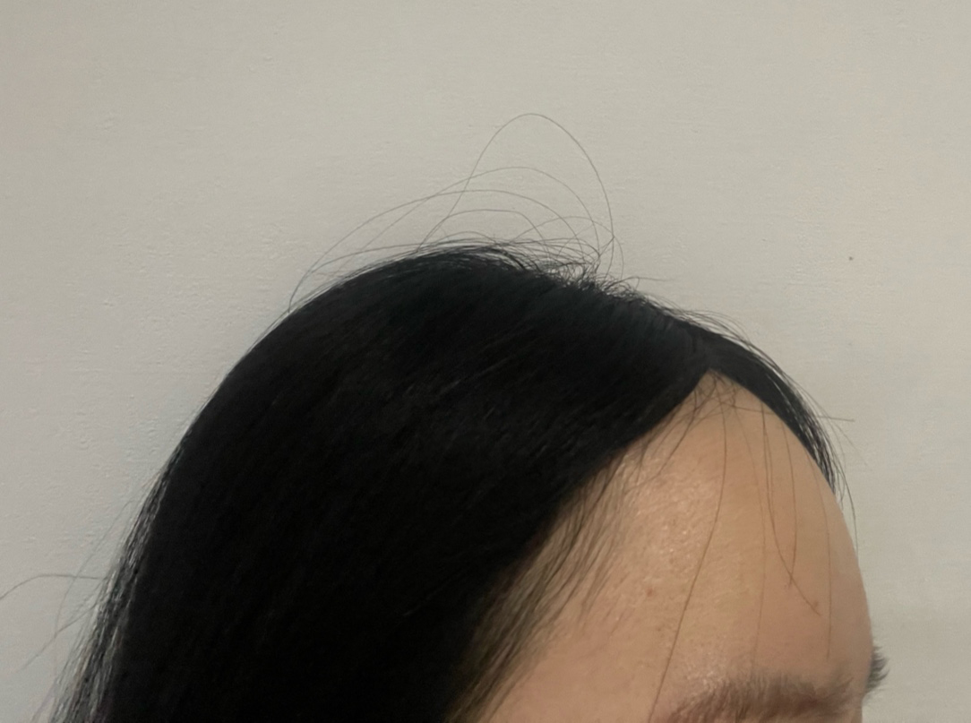 수술후기이미지