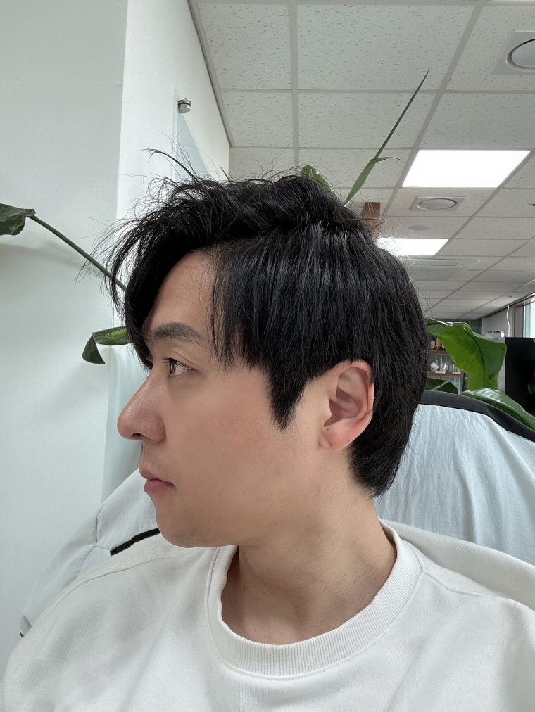 수술후기이미지