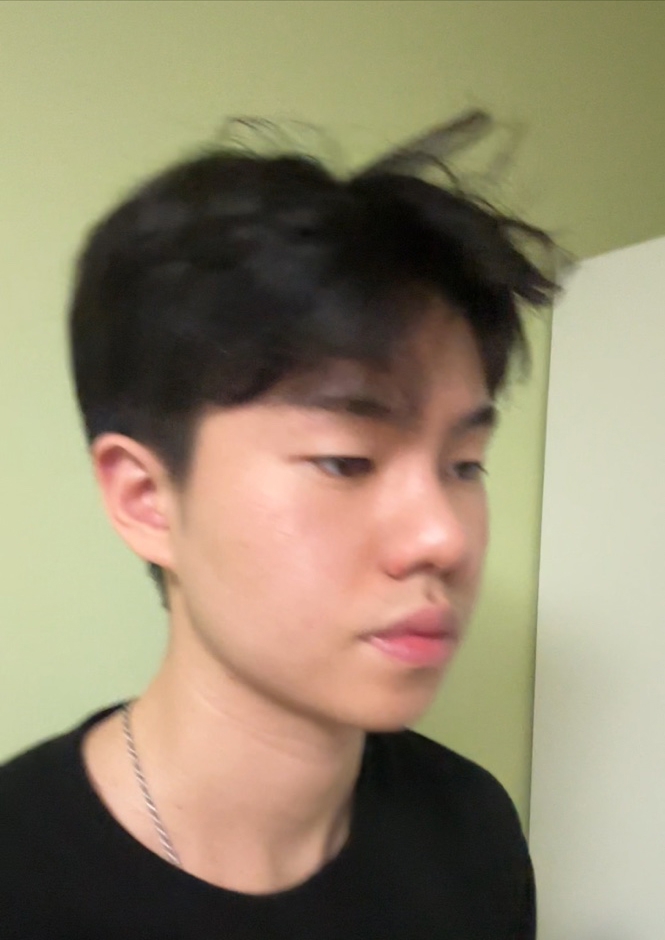 수술후기이미지