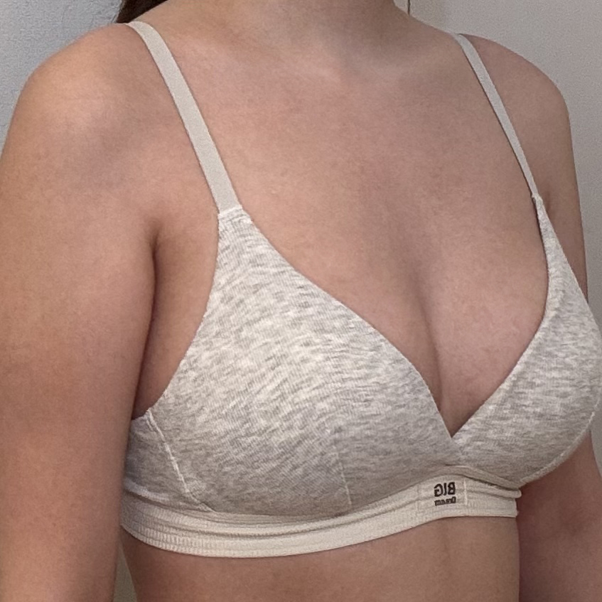 수술후기이미지