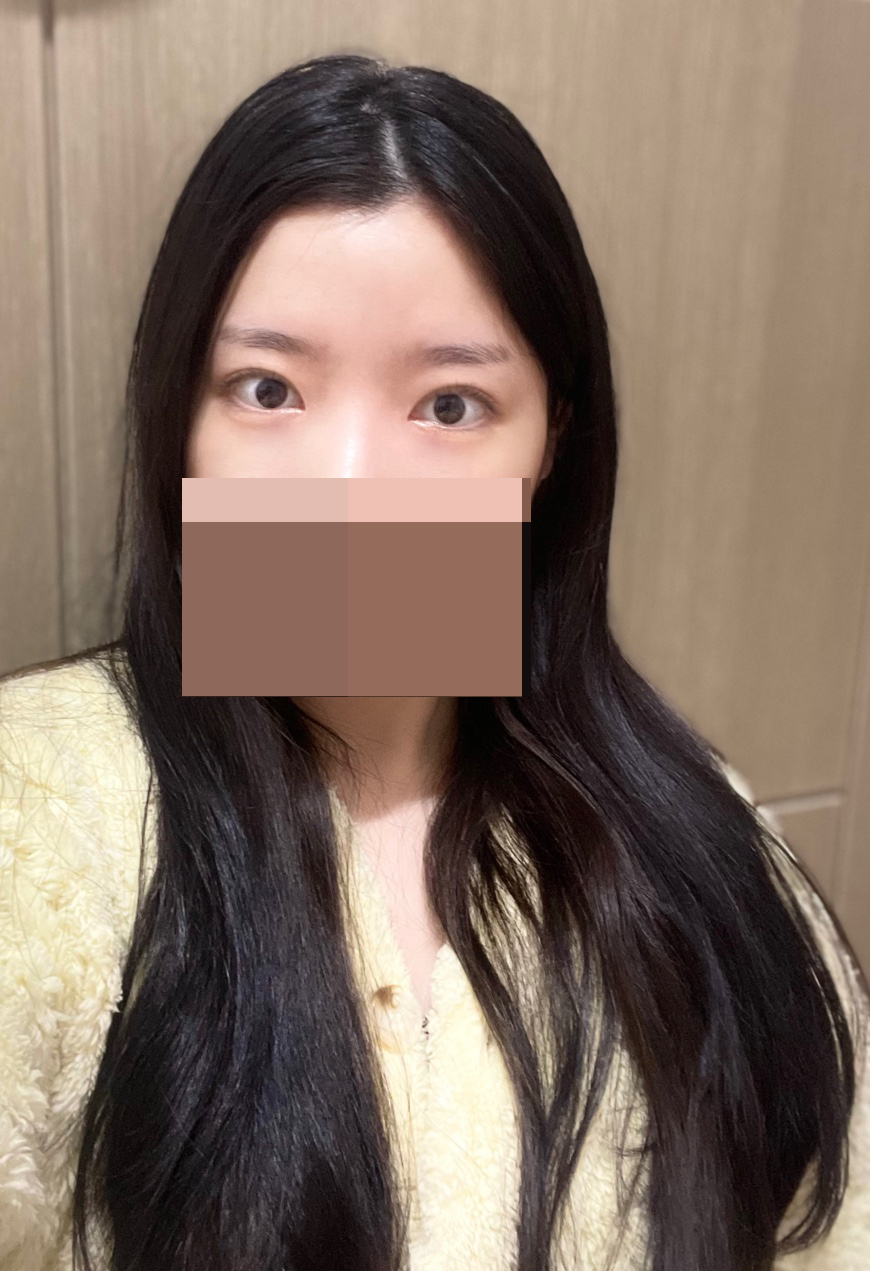 수술후기이미지