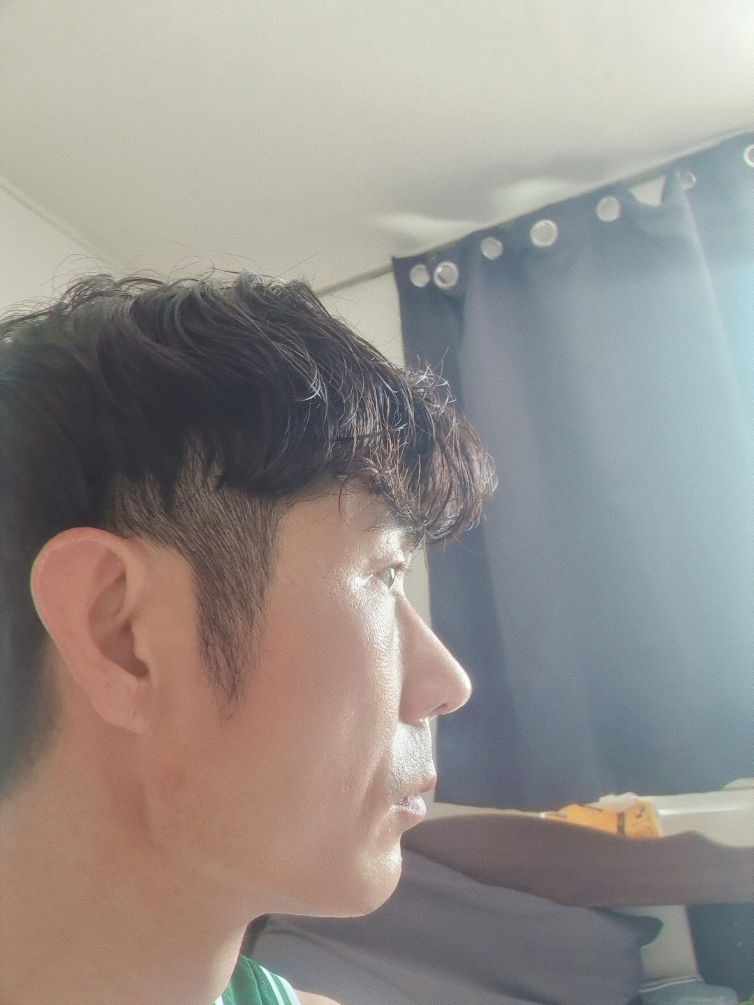 수술후기이미지