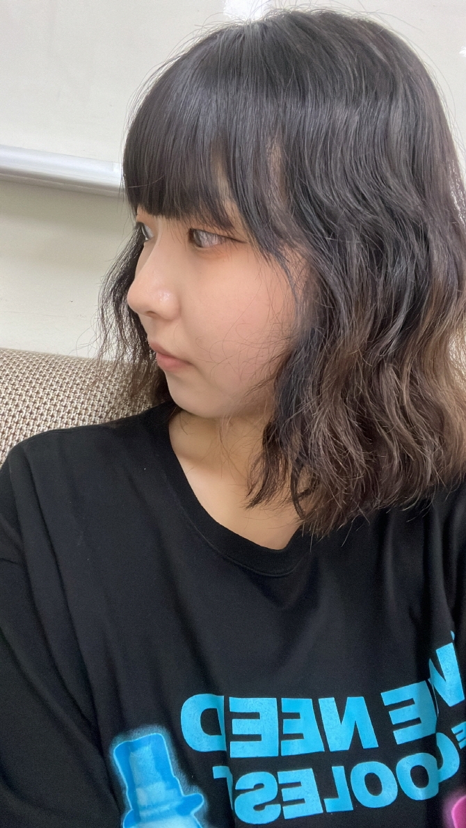 수술후기이미지