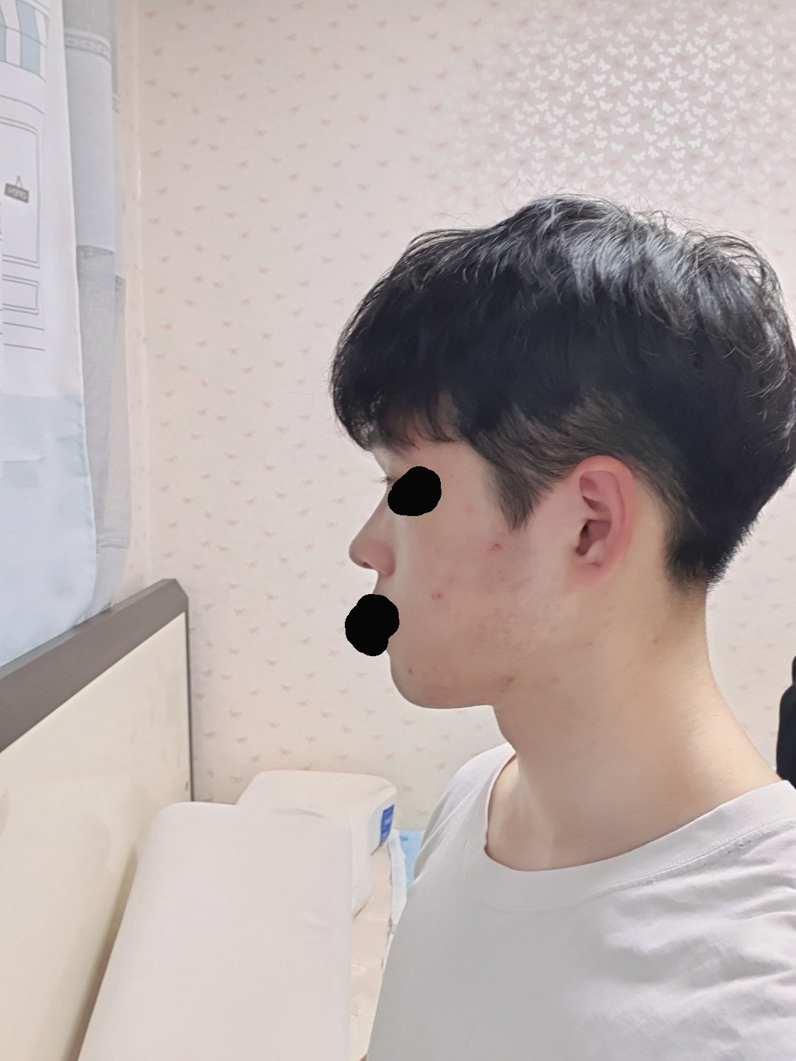 수술후기이미지