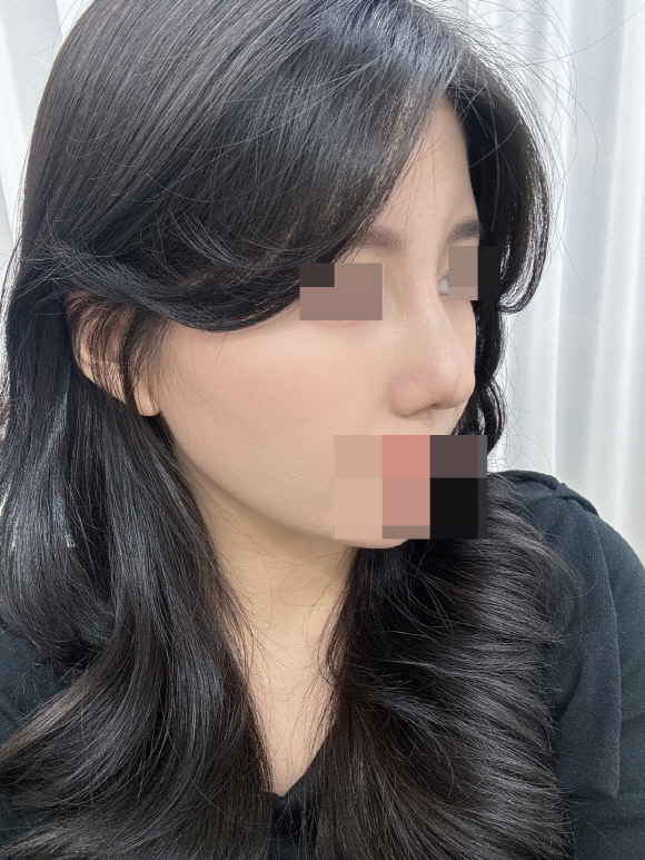 수술후기이미지