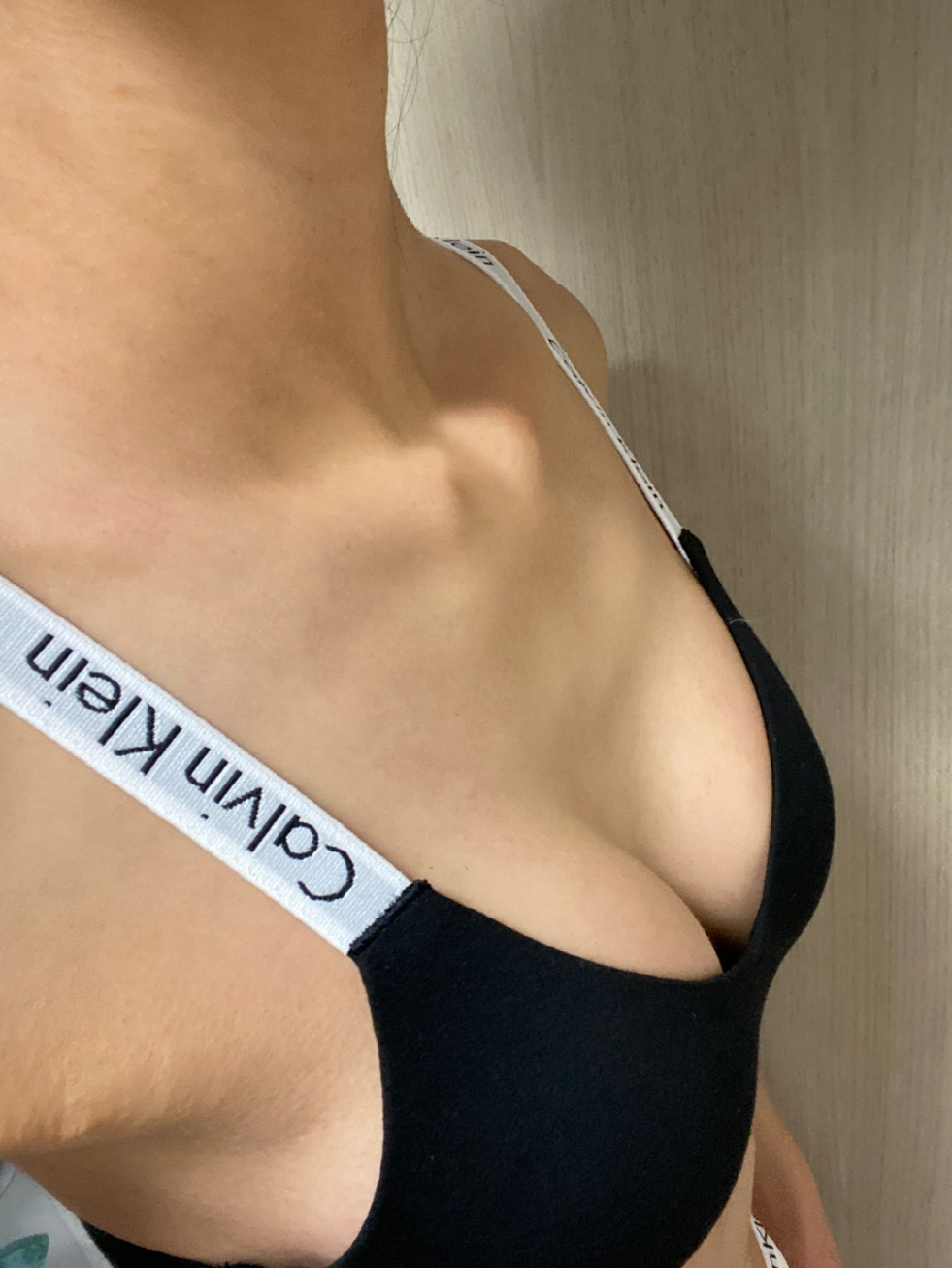 수술후기이미지